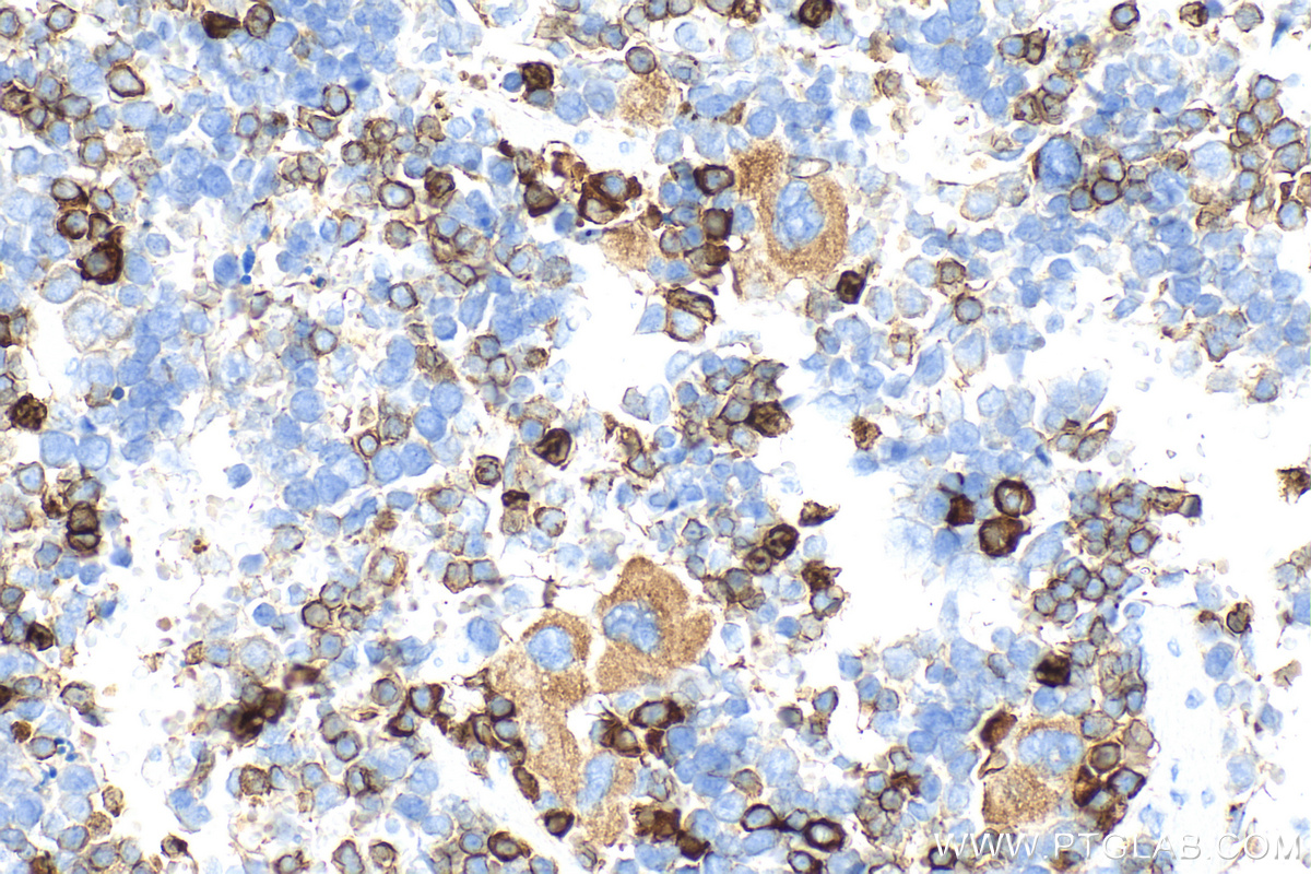 IHC staining of mouse spleen using 32395-1-AP