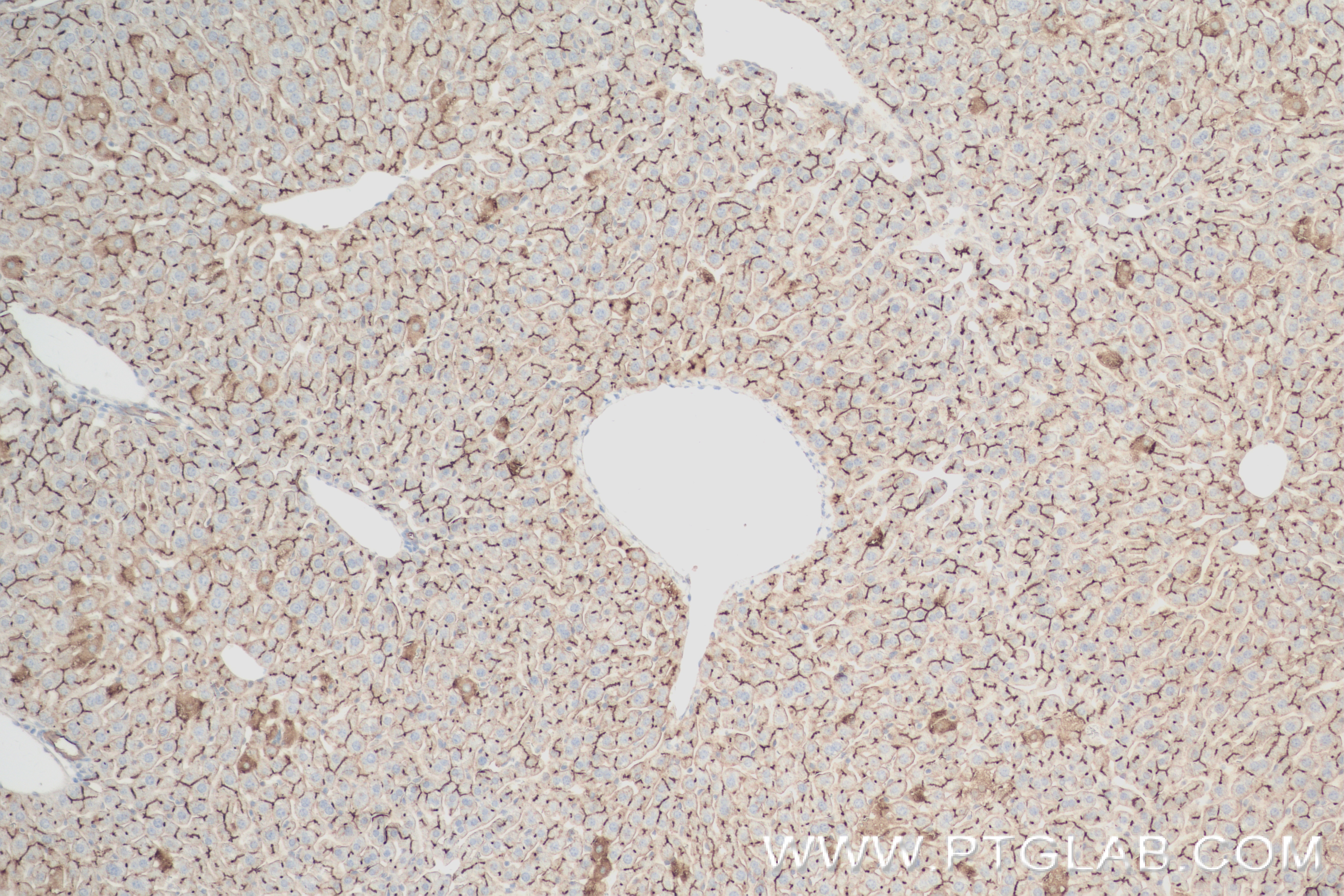 IHC staining of mouse liver using 84409-4-RR (same clone as 84409-4-PBS)