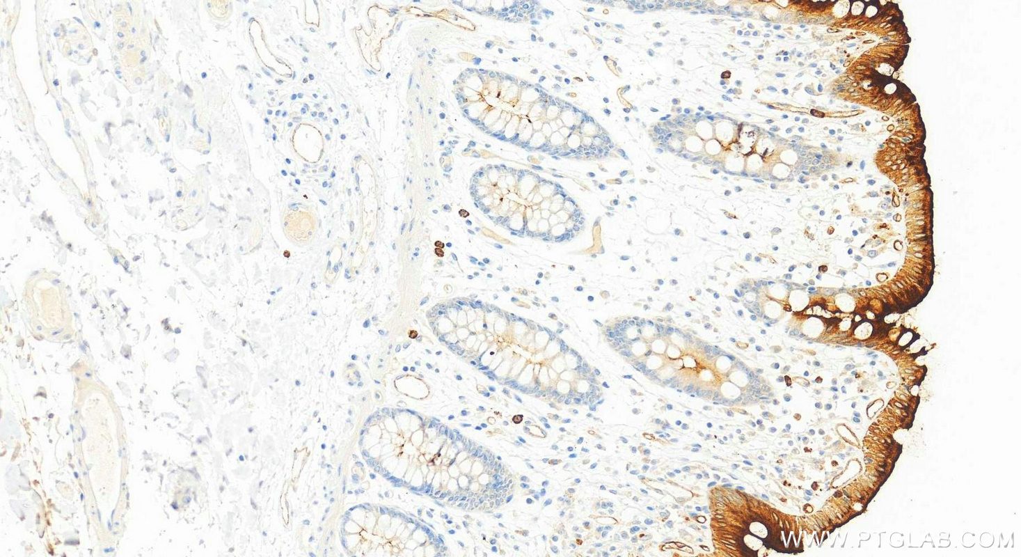 IHC staining of human colon using 83524-3-RR