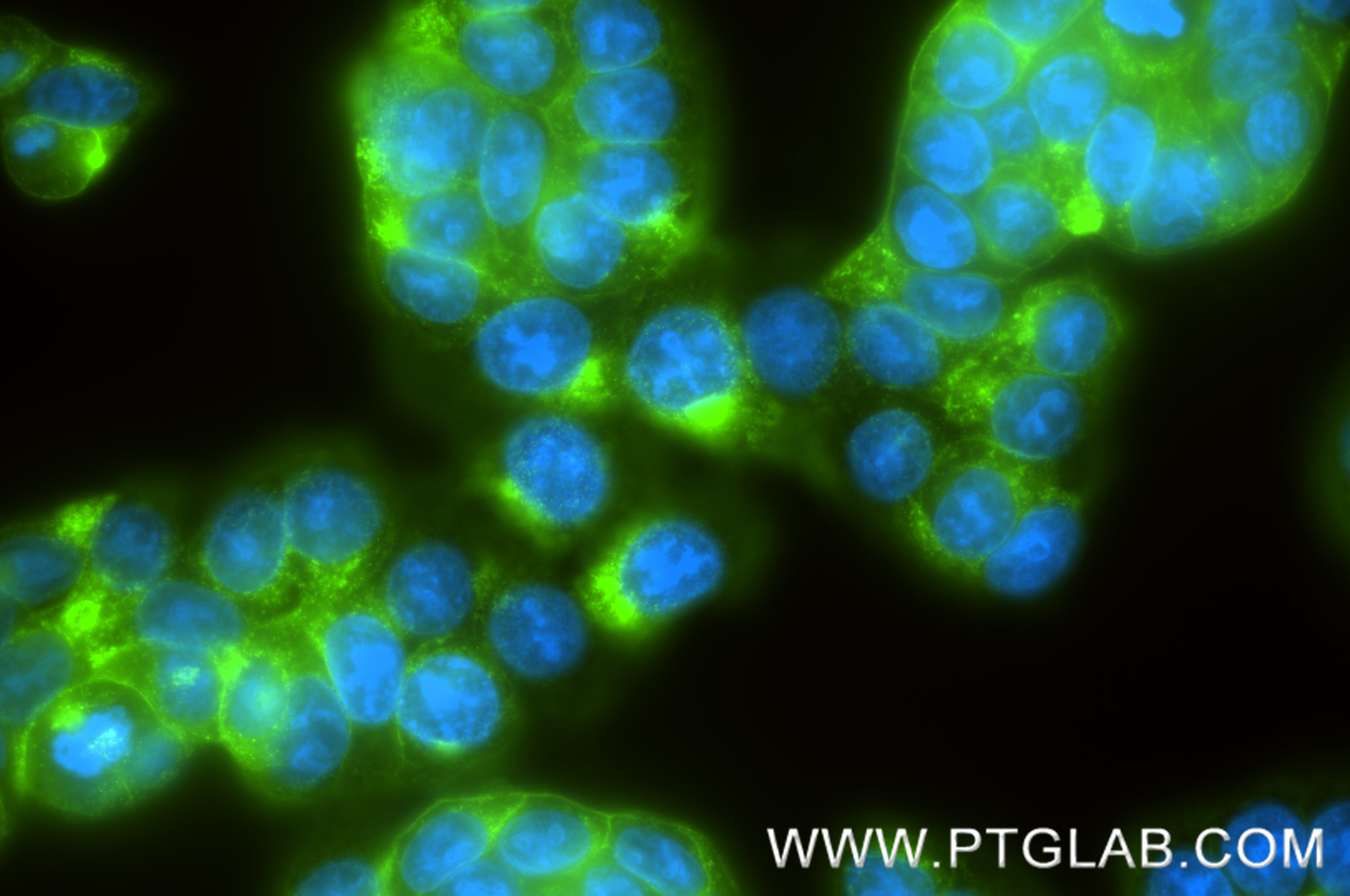IF Staining of HT-29 using 83524-8-RR IF Staining of HT-29 using 83524-8-RR