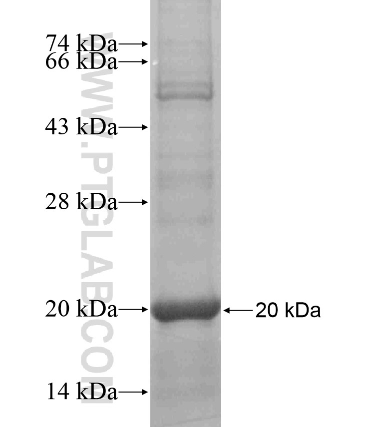 CEACAM1 fusion protein Ag17651 SDS-PAGE CEACAM1 fusion protein Ag17651 SDS-PAGE
