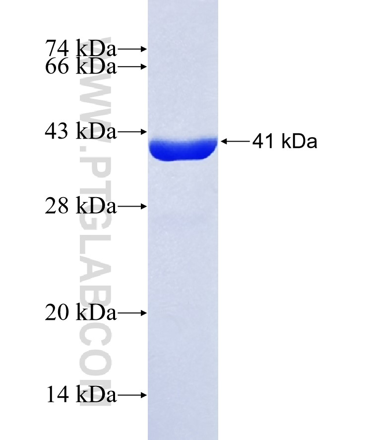 CEACAM16 fusion protein Ag37542 SDS-PAGE CEACAM16 fusion protein Ag37542 SDS-PAGE
