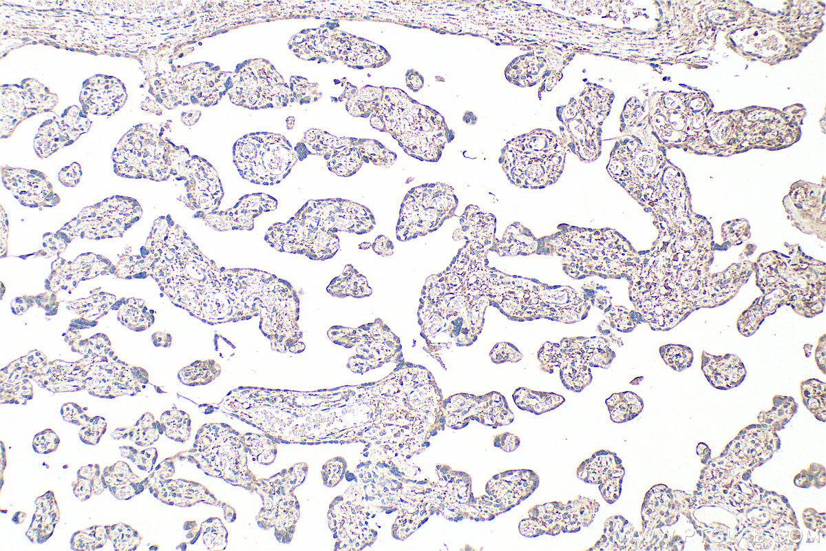 Immunohistochemical analysis of paraffin-embedded human placenta tissue slide using 17209-1-AP (CEACAM21 antibody) at dilution of 1:200 (under 10x lens). Heat mediated antigen retrieval with Tris-EDTA buffer (pH 9.0). IHC staining of human placenta using 17209-1-AP