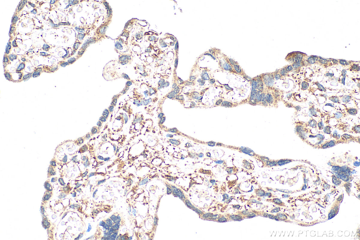 Immunohistochemical analysis of paraffin-embedded human placenta tissue slide using 17209-1-AP (CEACAM21 antibody) at dilution of 1:200 (under 40x lens). Heat mediated antigen retrieval with Tris-EDTA buffer (pH 9.0). IHC staining of human placenta using 17209-1-AP