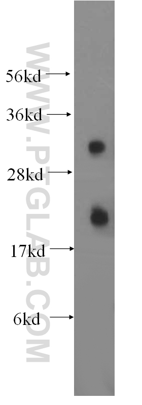 WB analysis of HeLa using 17209-1-AP