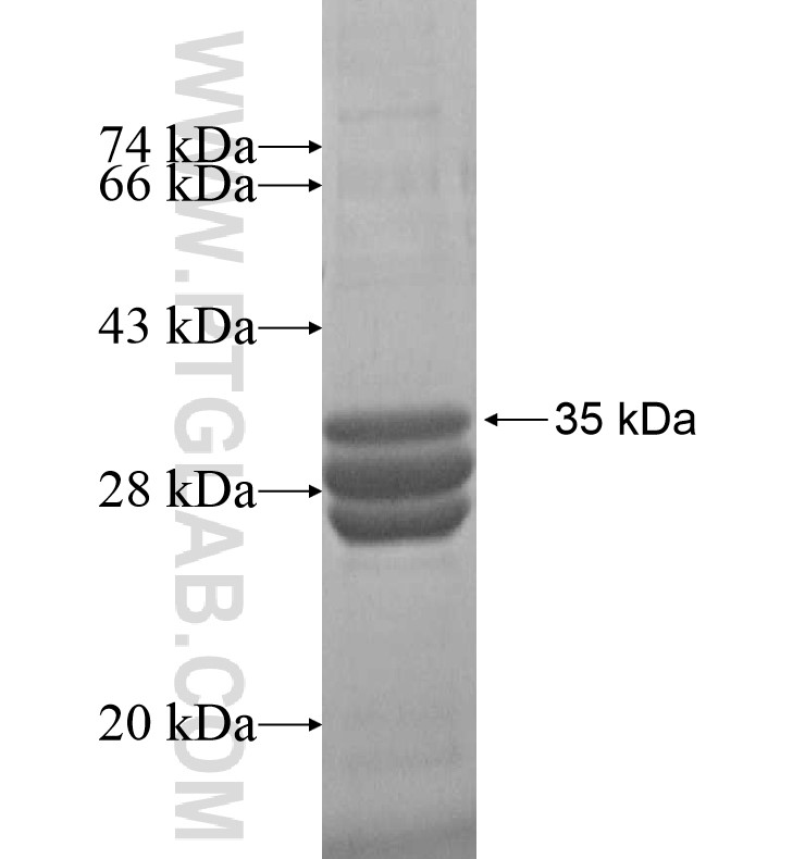 CEACAM3 fusion protein Ag16632 SDS-PAGE CEACAM3 fusion protein Ag16632 SDS-PAGE