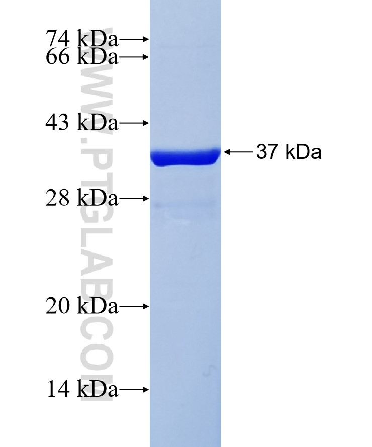 CEACAM4 fusion protein Ag37952 SDS-PAGE CEACAM4 fusion protein Ag37952 SDS-PAGE