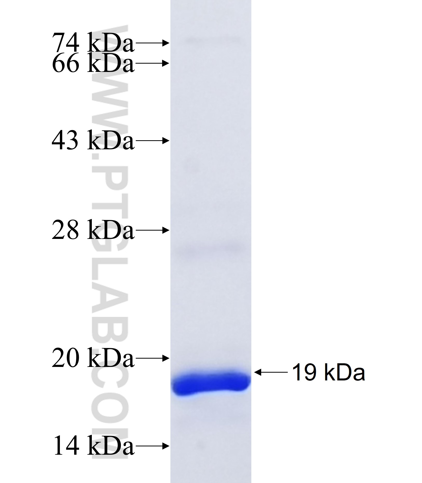 CEACAM4 fusion protein Ag38074 SDS-PAGE CEACAM4 fusion protein Ag38074 SDS-PAGE