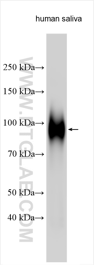 WB analysis using 30875-1-AP