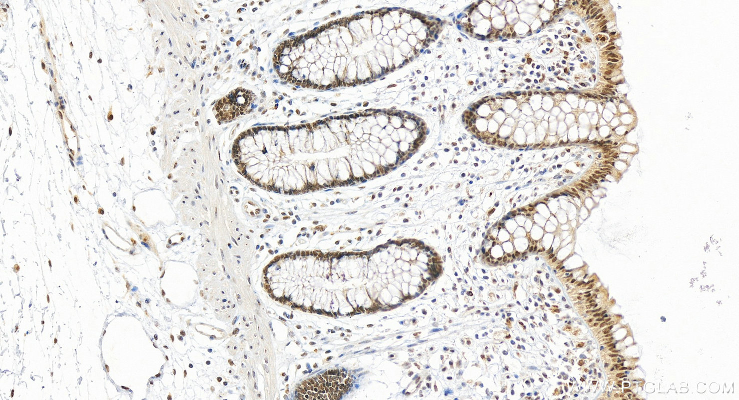 IHC staining of human colon using 29388-1-AP