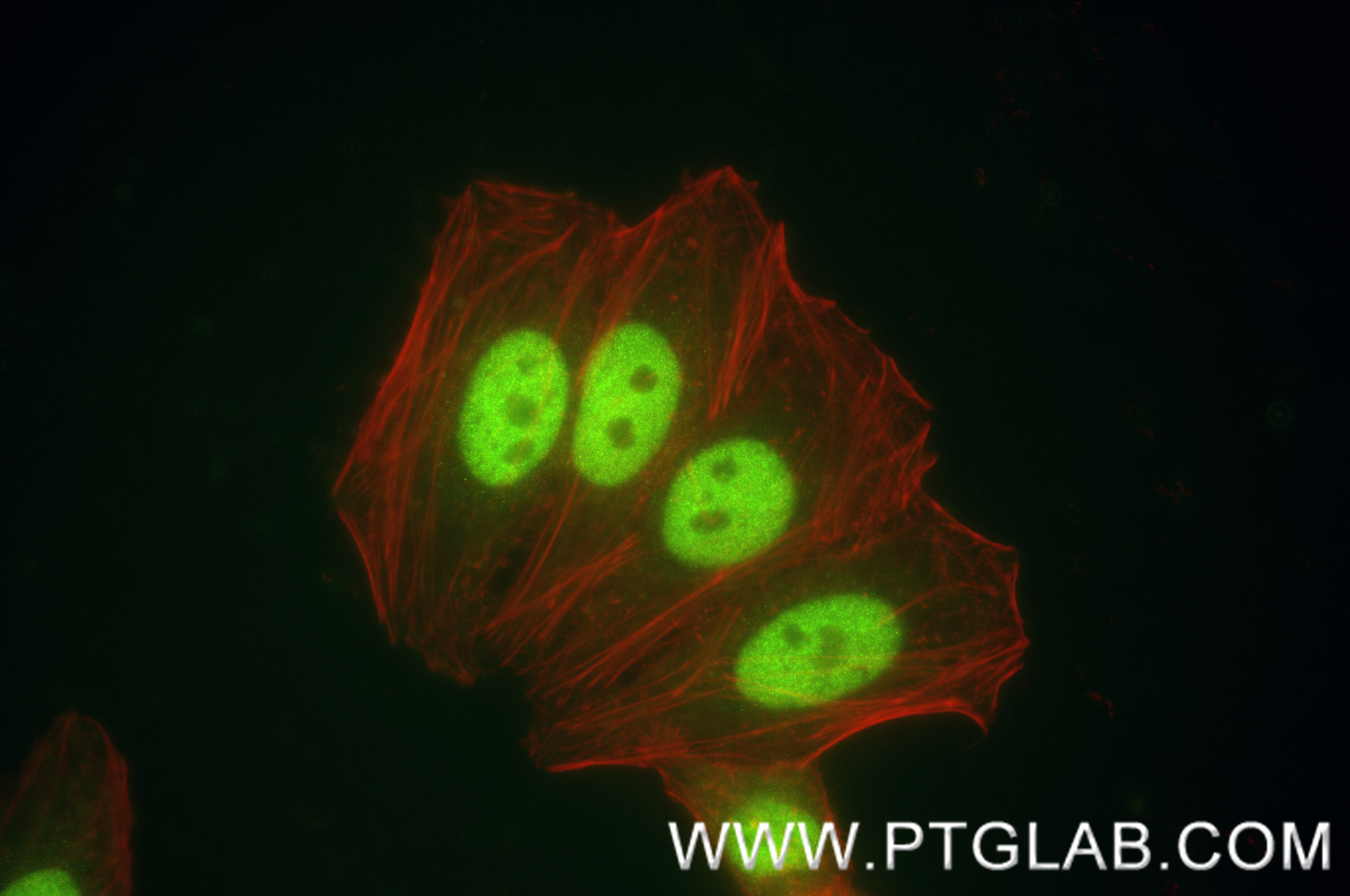 IF Staining of HepG2 using 84668-4-RR (same clone as 84668-4-PBS)