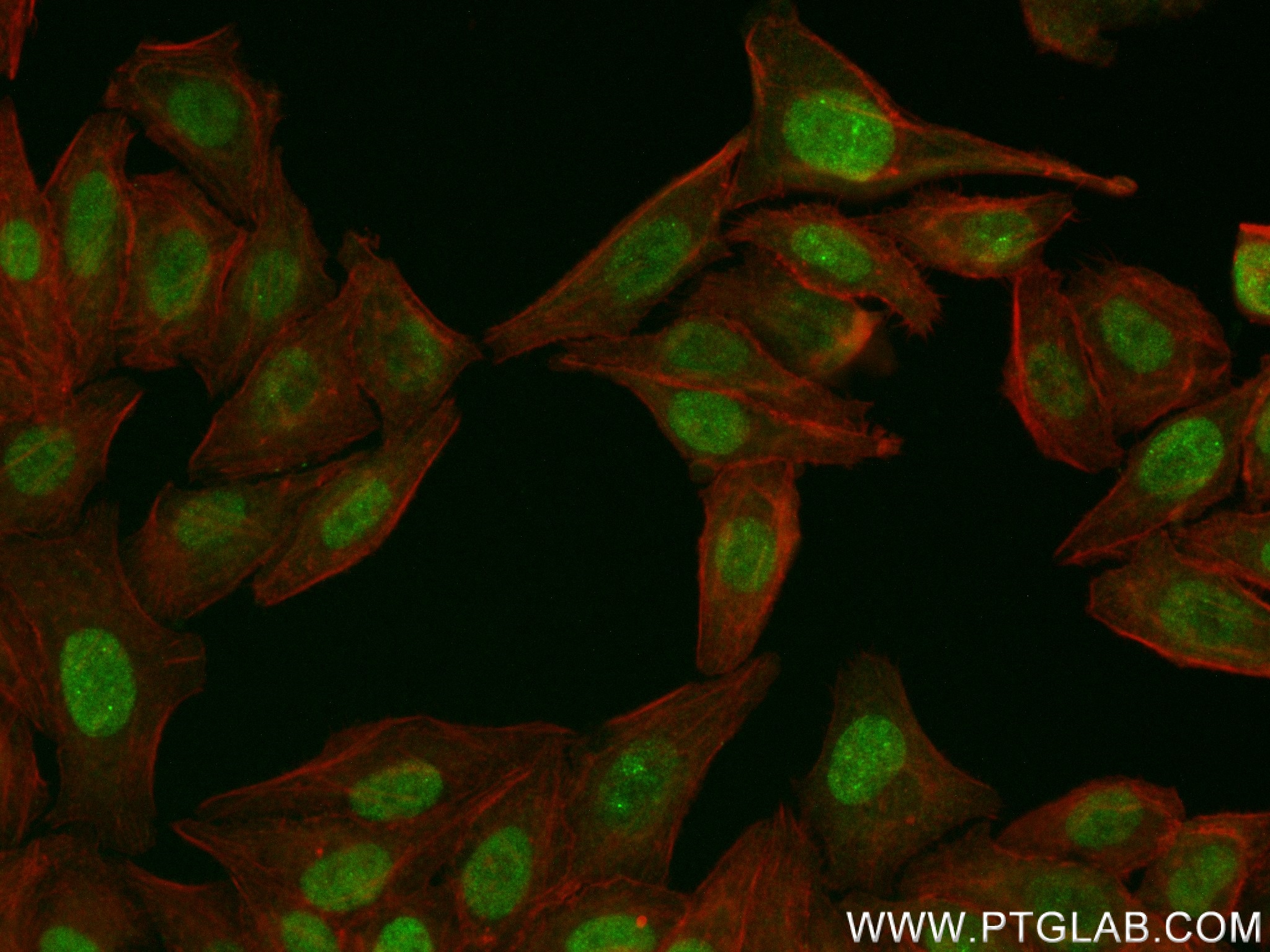 IF Staining of HepG2 using 83791-6-RR