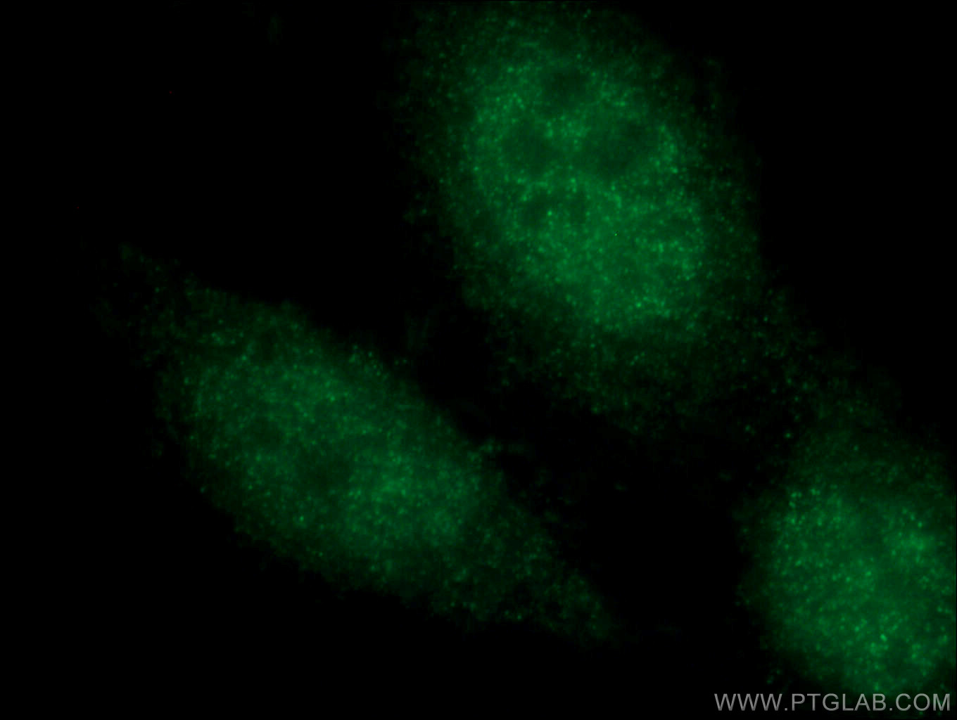 IF Staining of HepG2 using 14271-1-AP