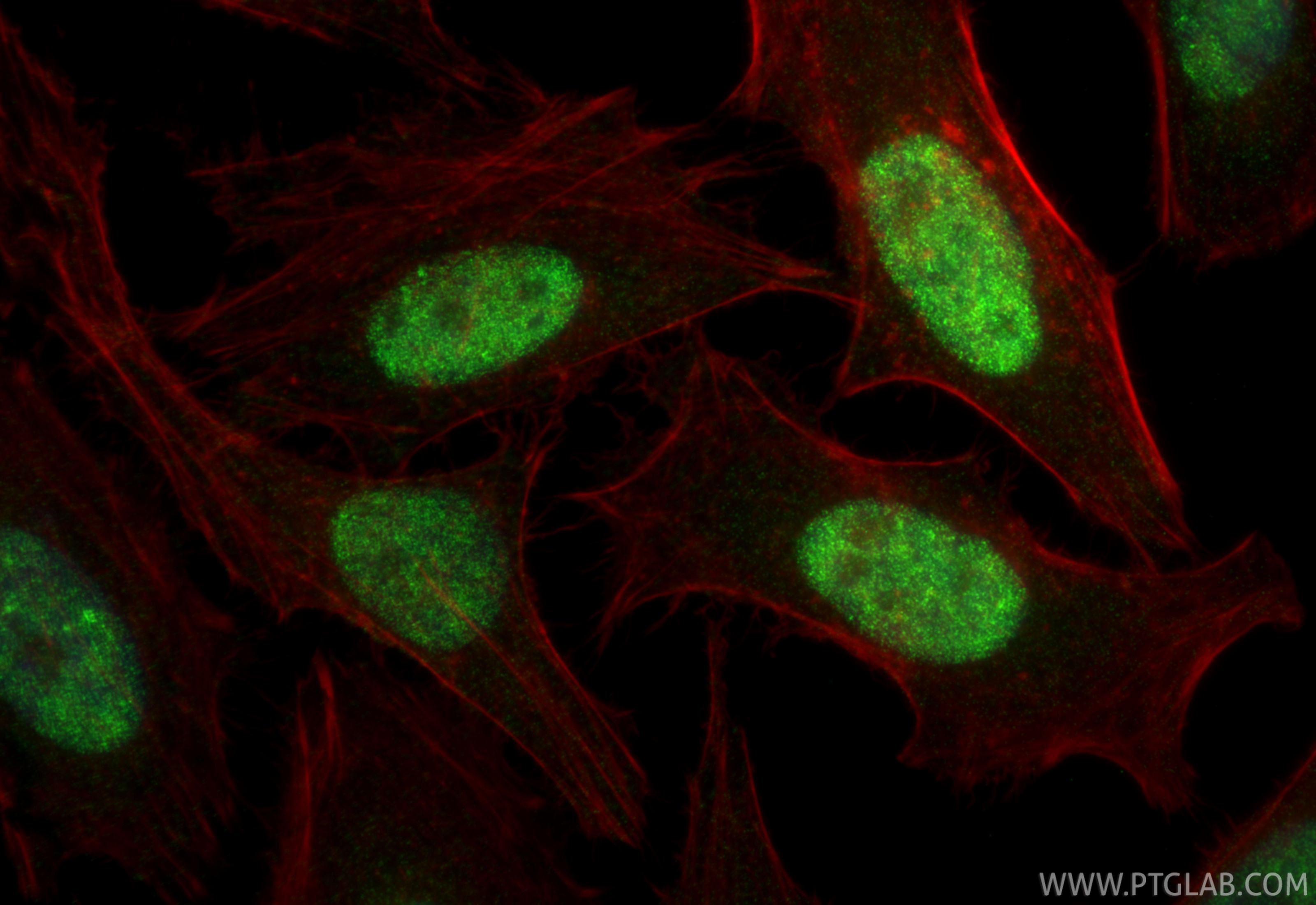 IF Staining of HeLa using 86432-1-RR