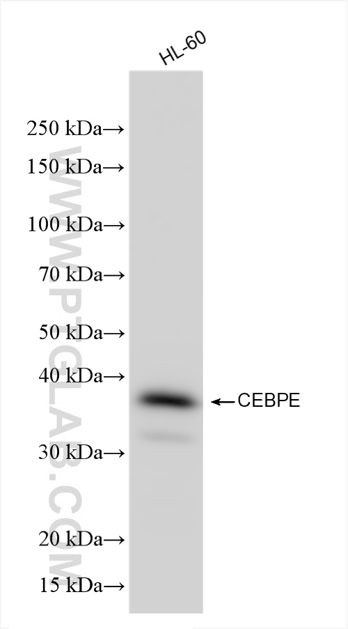WB analysis of HL-60 using 86432-1-RR