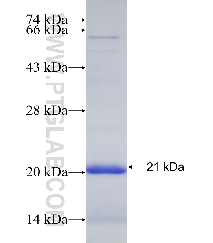 CECR2 fusion protein Ag32908 SDS-PAGE CECR2 fusion protein Ag32908 SDS-PAGE