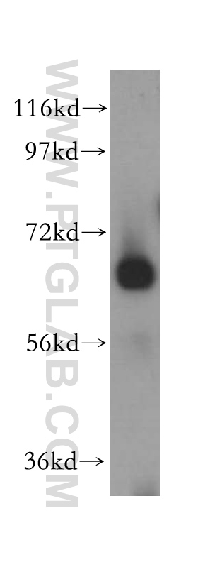 WB analysis of human liver using 15384-1-AP