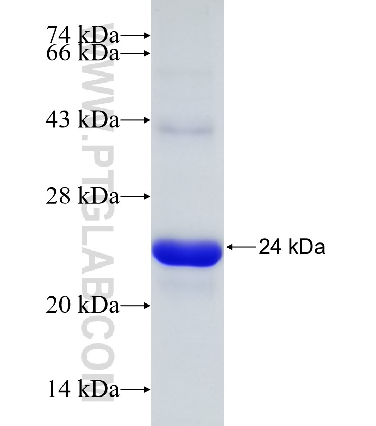CEND1 fusion protein Ag27801 SDS-PAGE CEND1 fusion protein Ag27801 SDS-PAGE