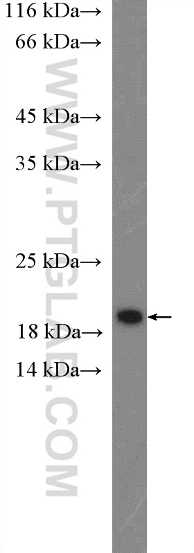 WB analysis of MCF-7 using 26754-1-AP