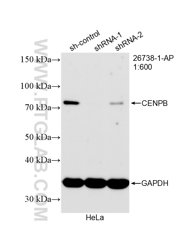 WB analysis of HeLa using 26738-1-AP (same clone as 26738-1-PBS)