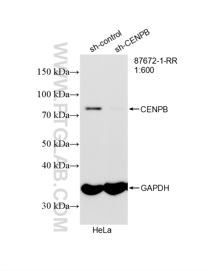 WB analysis of HeLa using 87672-1-RR (same clone as 87672-1-PBS)