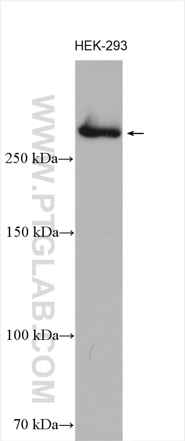 WB analysis using 28142-1-AP