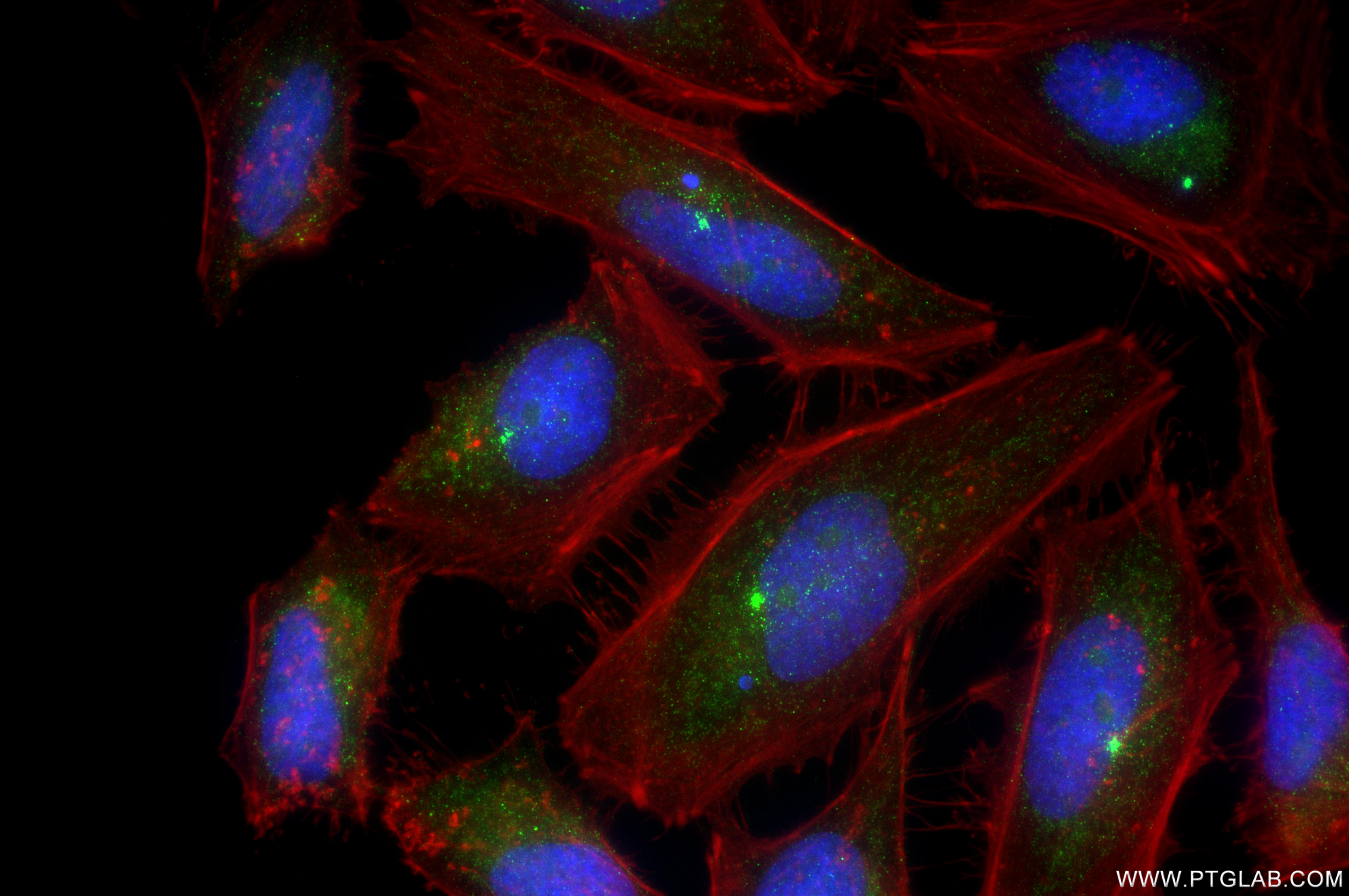 IF Staining of HeLa using 86805-3-RR (same clone as 86805-3-PBS) IF Staining of HeLa using 86805-3-RR (same clone as 86805-3-PBS)