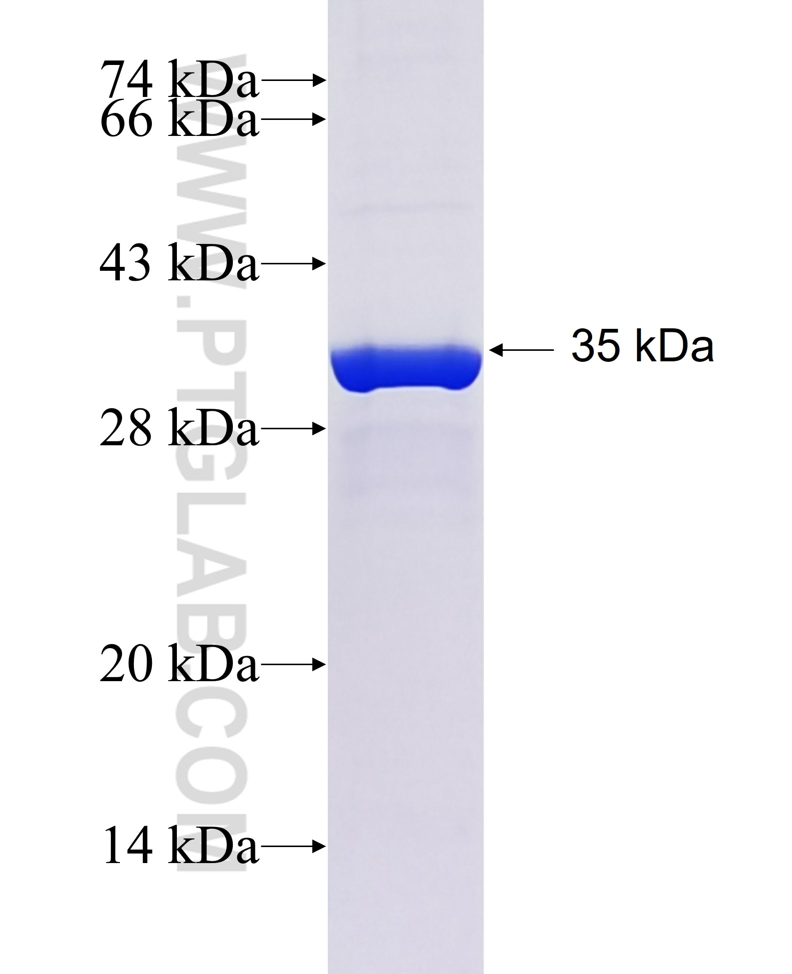 CENPE fusion protein Ag27230 SDS-PAGE