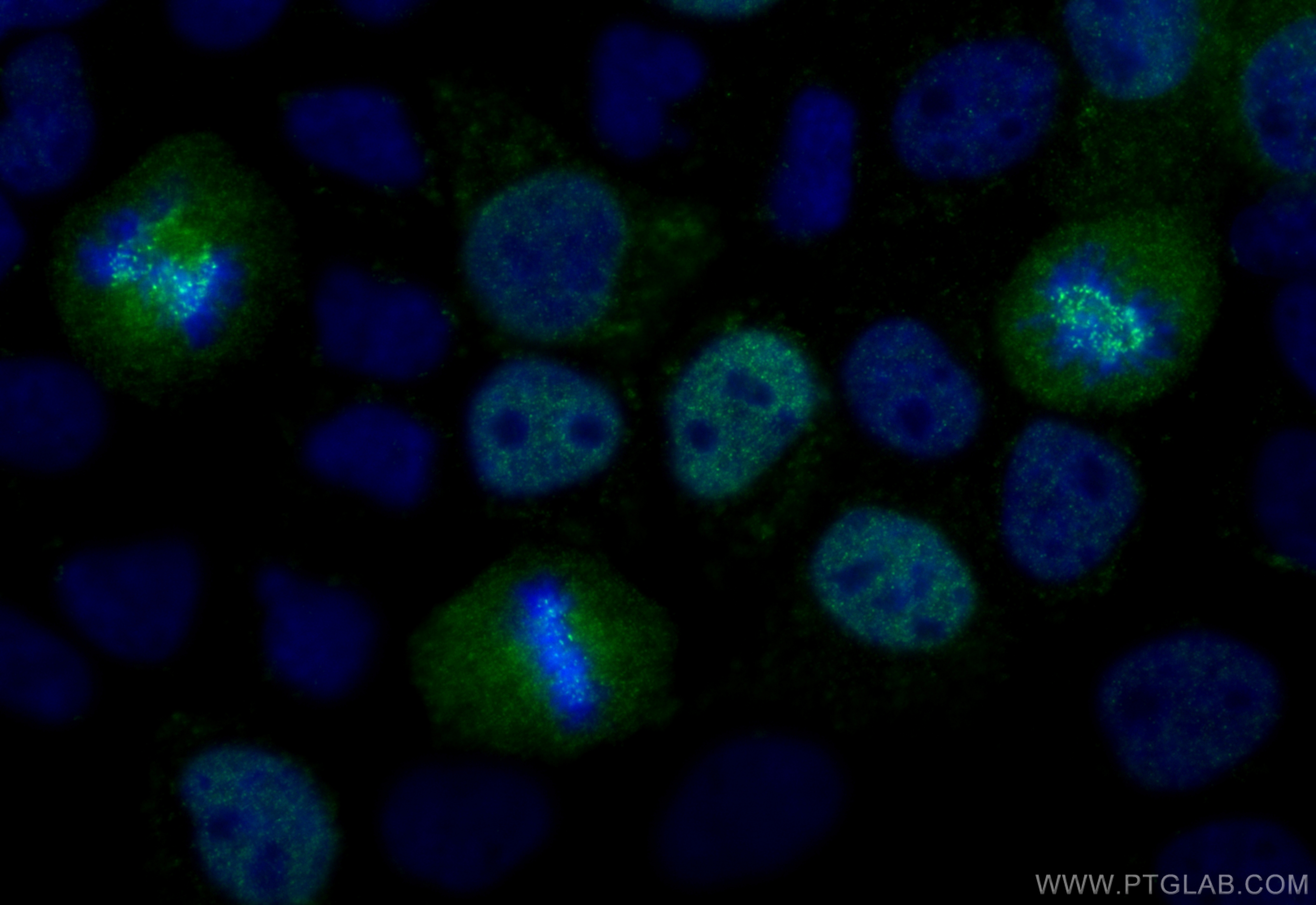 IF Staining of A431 using 84865-4-RR (same clone as 84865-4-PBS)