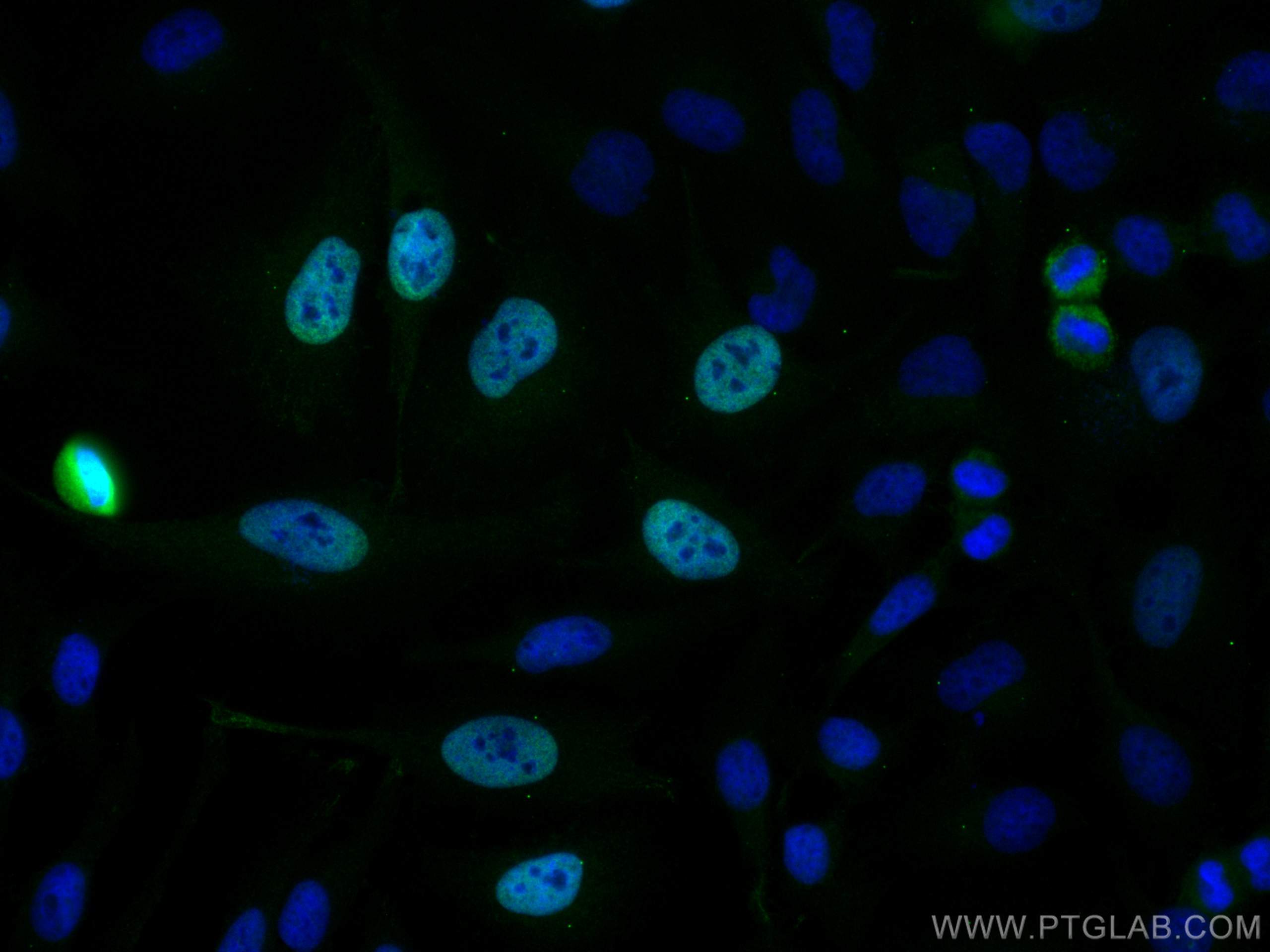 IF Staining of HeLa using CL488-28568