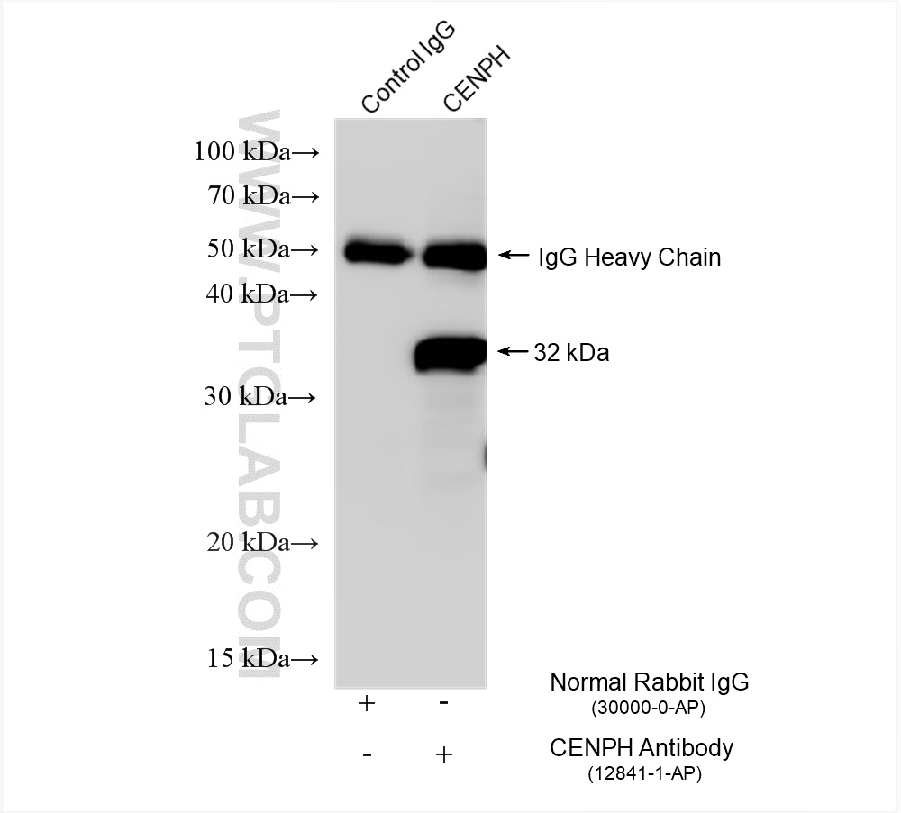 IP experiment of HeLa using 12841-1-AP