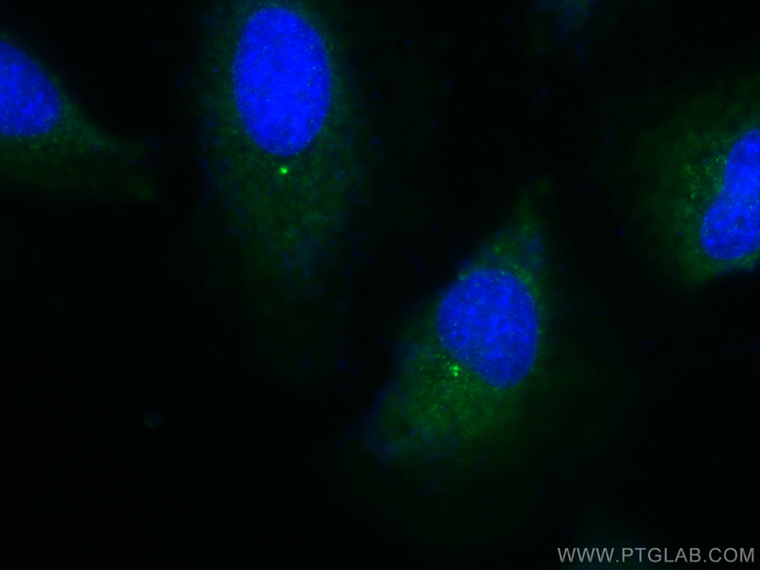 IF Staining of HeLa using 11517-1-AP