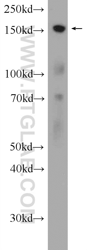 WB analysis of mouse testis using 11517-1-AP