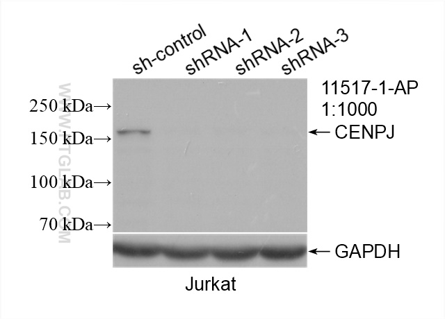 WB analysis of Jurkat using 11517-1-AP