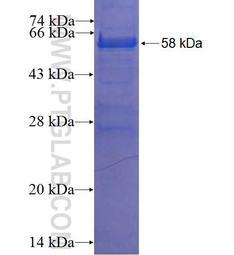 CENPK fusion protein Ag23812 SDS-PAGE CENPK fusion protein Ag23812 SDS-PAGE