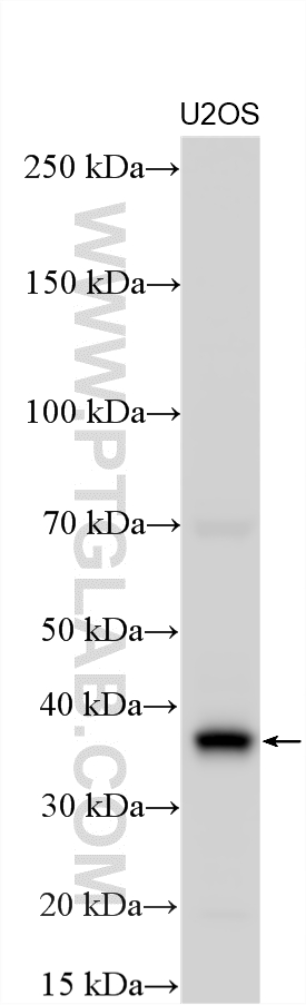 WB analysis using 17007-1-AP WB analysis using 17007-1-AP