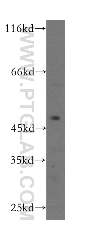 WB analysis of PC-3 using 17007-1-AP