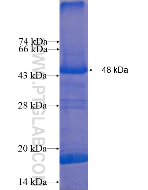 CENPL fusion protein Ag10930 SDS-PAGE CENPL fusion protein Ag10930 SDS-PAGE