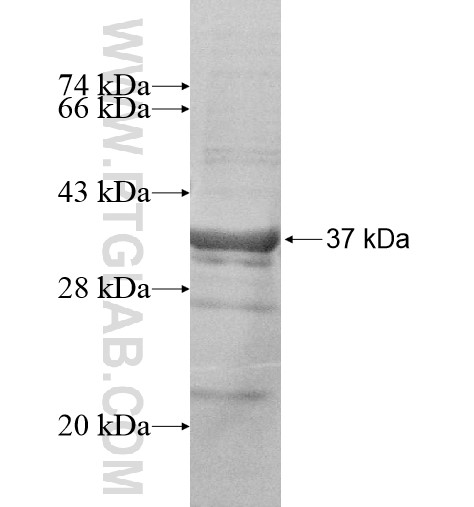 CENPQ fusion protein Ag10499 SDS-PAGE CENPQ fusion protein Ag10499 SDS-PAGE