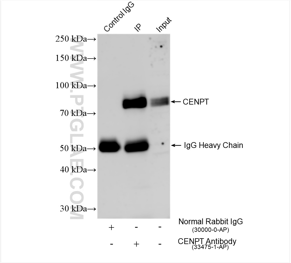 IP experiment of HEK-293T using 33475-1-AP IP experiment of HEK-293T using 33475-1-AP