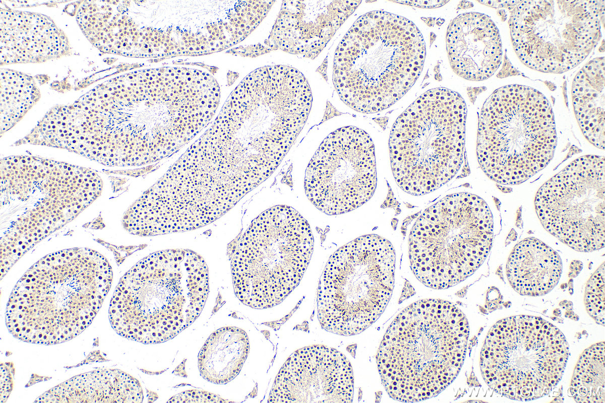 IHC staining of mouse testis using 23005-1-AP