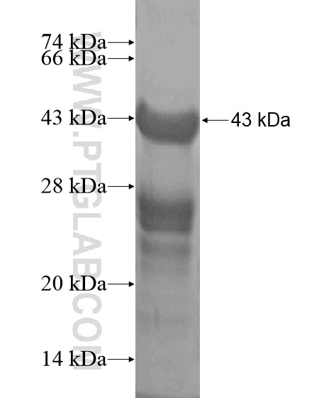 CENPV fusion protein Ag19210 SDS-PAGE CENPV fusion protein Ag19210 SDS-PAGE