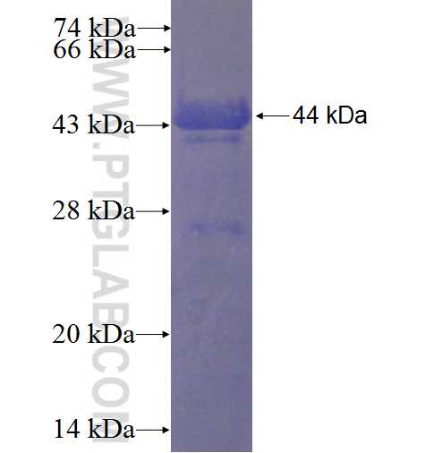 CENTD3 fusion protein Ag24116 SDS-PAGE CENTD3 fusion protein Ag24116 SDS-PAGE