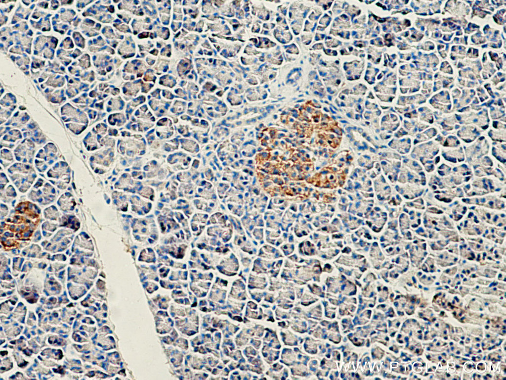 IHC staining of human pancreas using 24067-1-AP