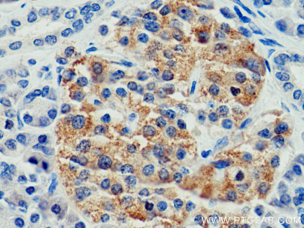 IHC staining of human pancreas using 24067-1-AP