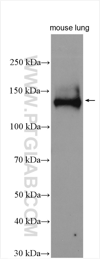 WB analysis of mouse lung using 24067-1-AP