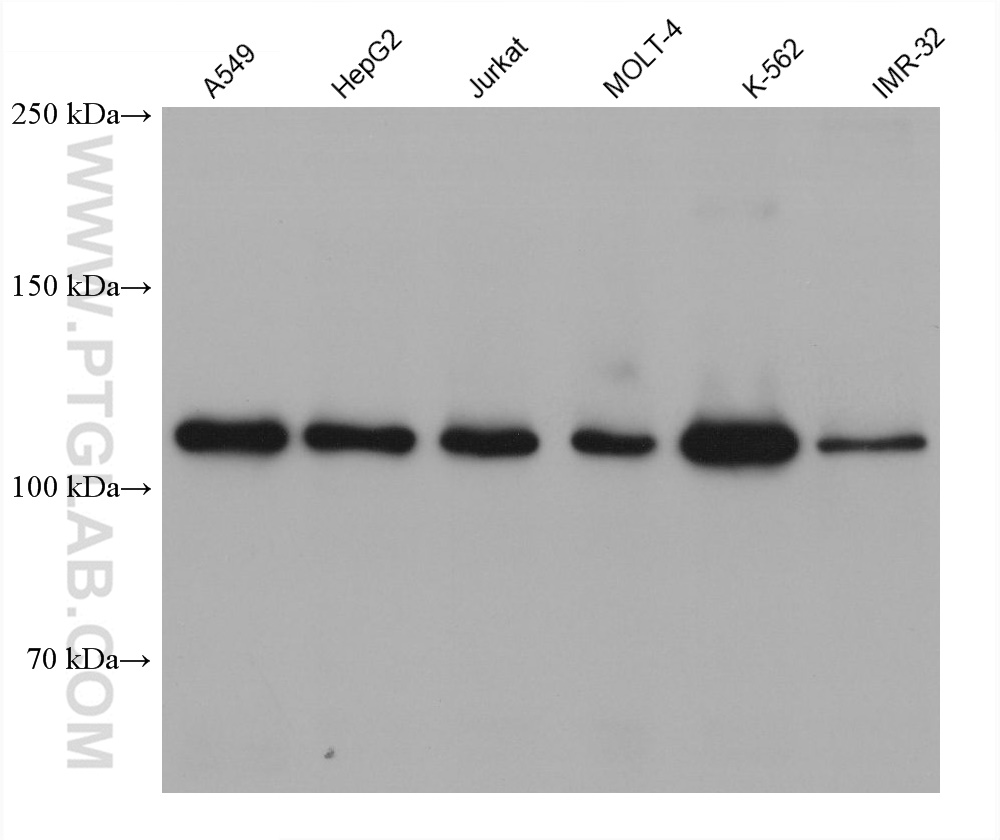 WB analysis using 60468-1-Ig