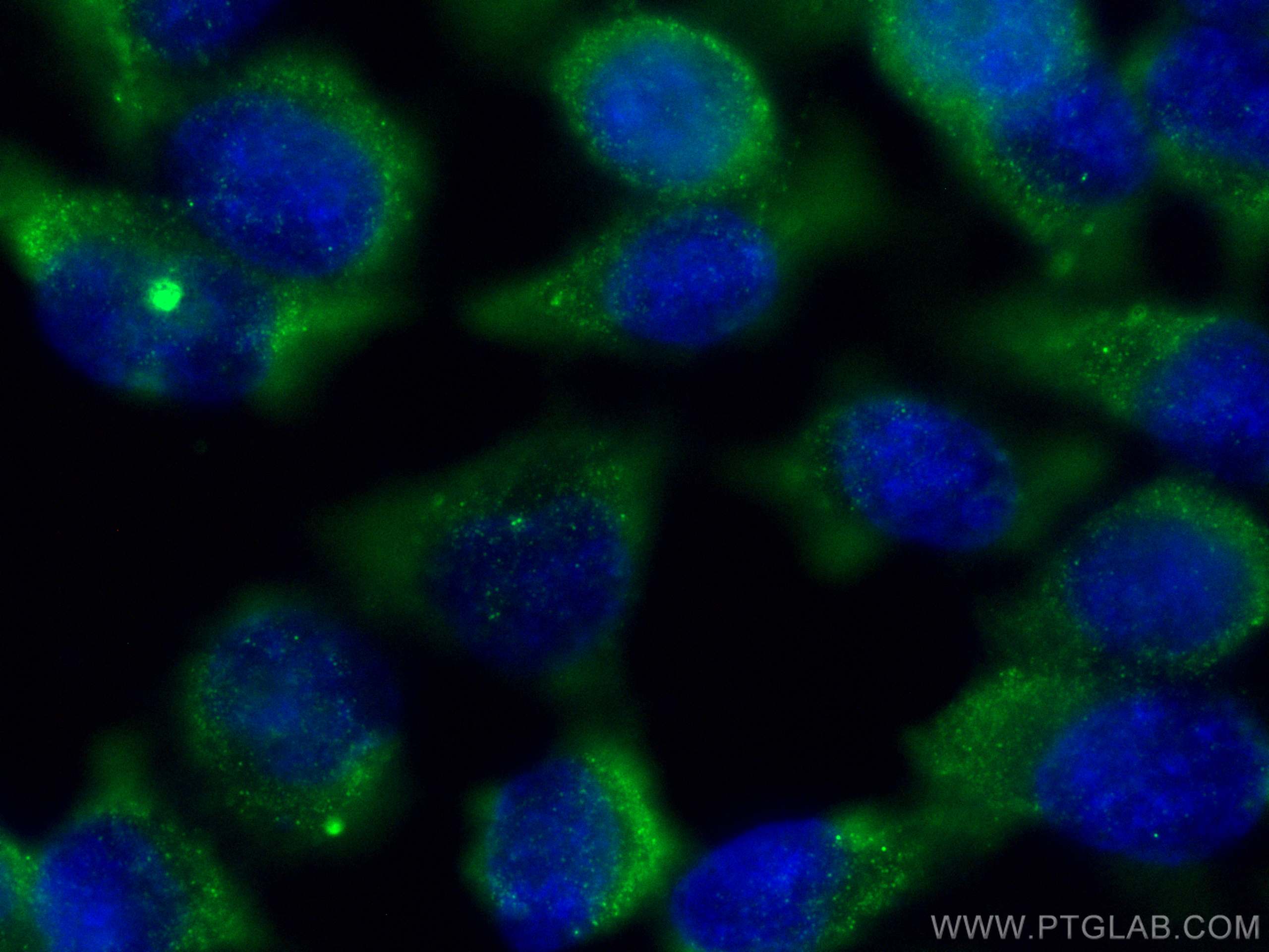 IF Staining of HeLa using 68715-1-Ig (same clone as 68715-1-PBS)