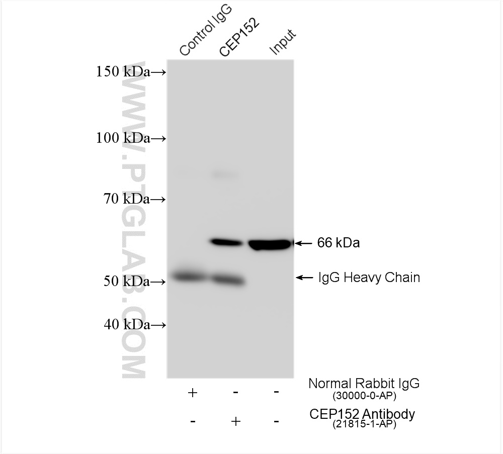 IP experiment of mouse brain using 21815-1-AP