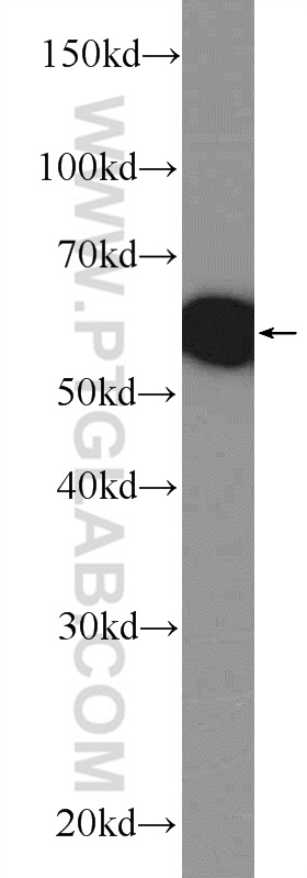 WB analysis of mouse brain using 21815-1-AP